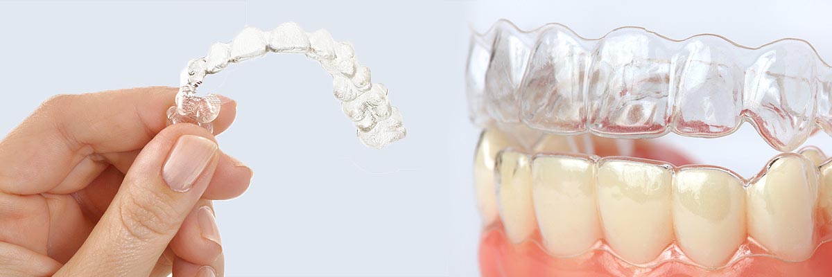 Florence Alternative to Braces for Teens