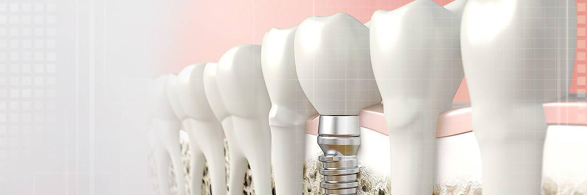 Florence Dental Prosthetics