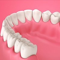 Gum Disease Florence, KY