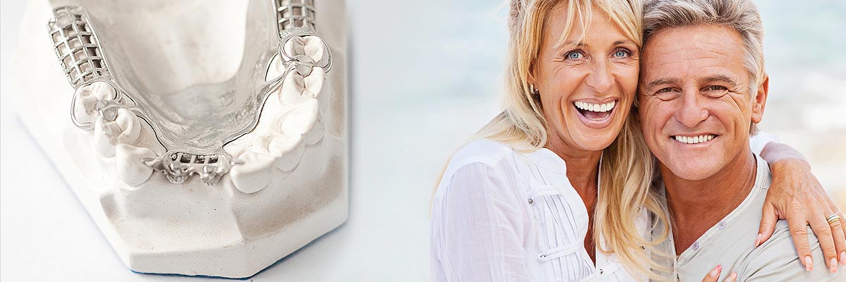 Florence Implant Supported Dentures