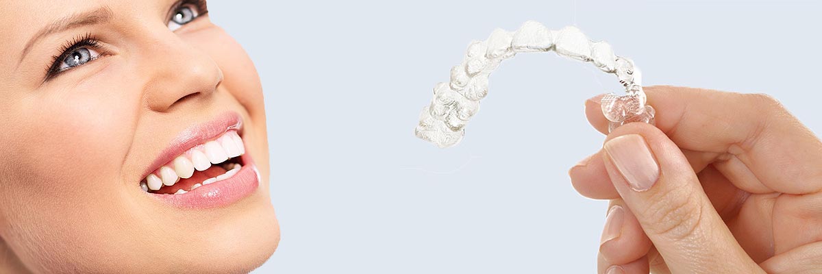 Florence 7 Things Parents Need to Know About Invisalign Teen