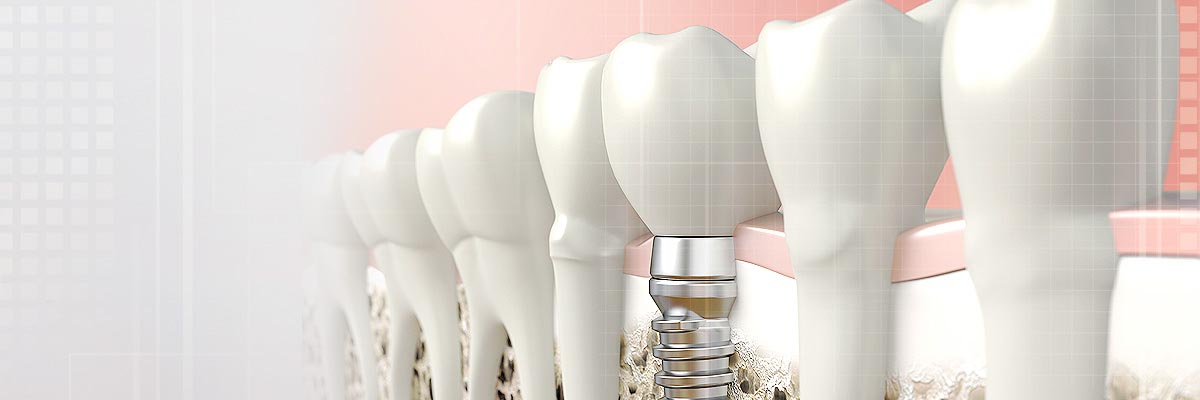Florence Oral Prosthetics Doctor