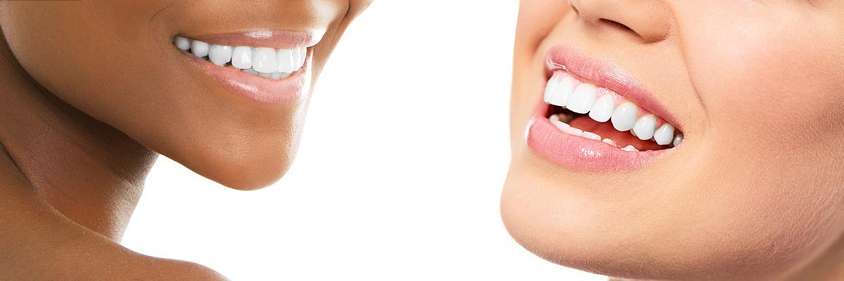 Florence Teeth Whitening