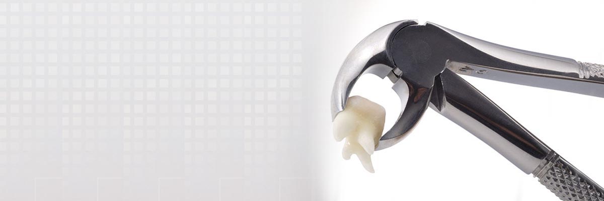 Florence Tooth Extraction